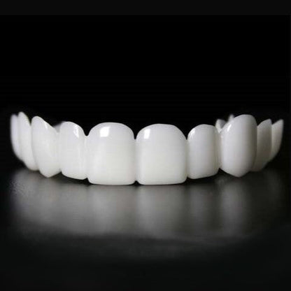 Snap-On Dental Veneers for Upper and Lower Teeth