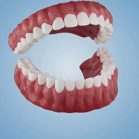 FlexiSmile Complete Denture System for Enhanced Comfort