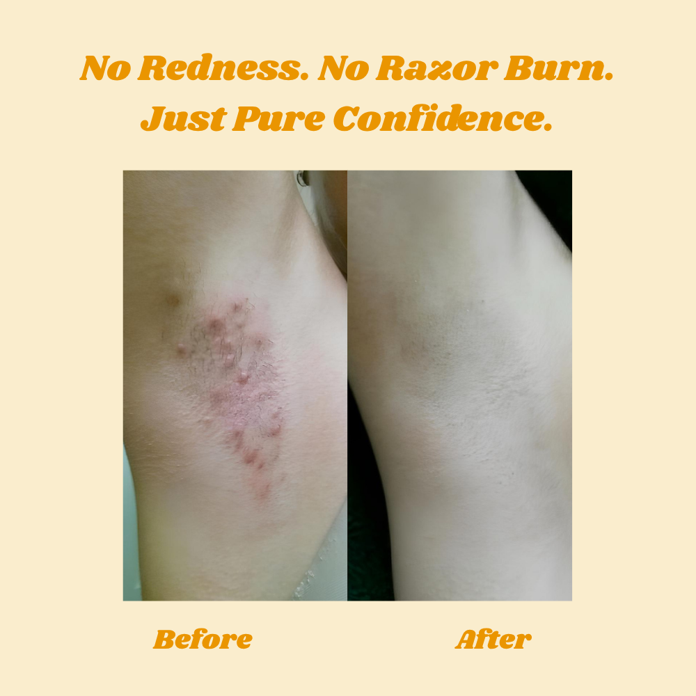 SilkenGlow™ - Experience Pain-Free, Irresistibly Smooth Skin for Weeks
