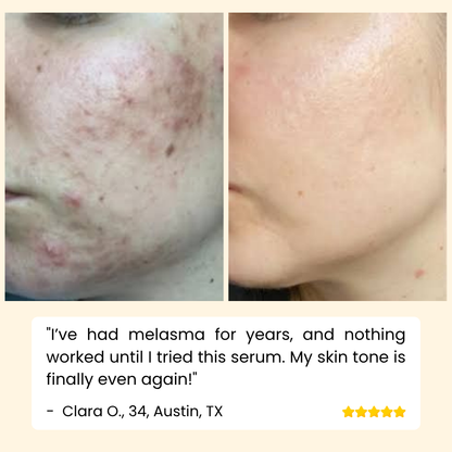 RadiantGlow Essence — Banish Dark Spots for Luminous Skin | Buy One Get One Free