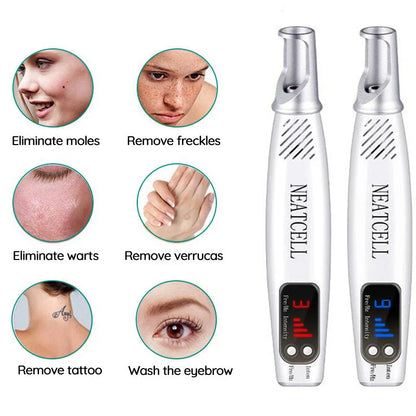 Laser Tattoo Eraser Pen - Red and Blue Light Removal Device