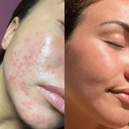 RadianceWave™ – Gentle LED Therapy for Flawless Skin