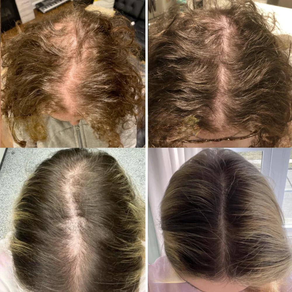 Nourishing Hair Elixir with 11 Essential Oils | Scalp & Hair Care | Vegan, Silicone-Free, Paraben-Free | Suitable for All Hair Types