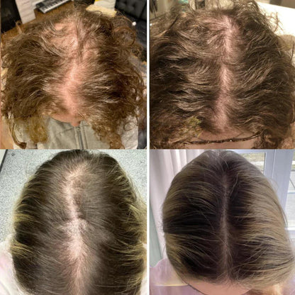 Nourishing Hair Elixir with 11 Essential Oils | Scalp & Hair Care | Vegan, Silicone-Free, Paraben-Free | Suitable for All Hair Types