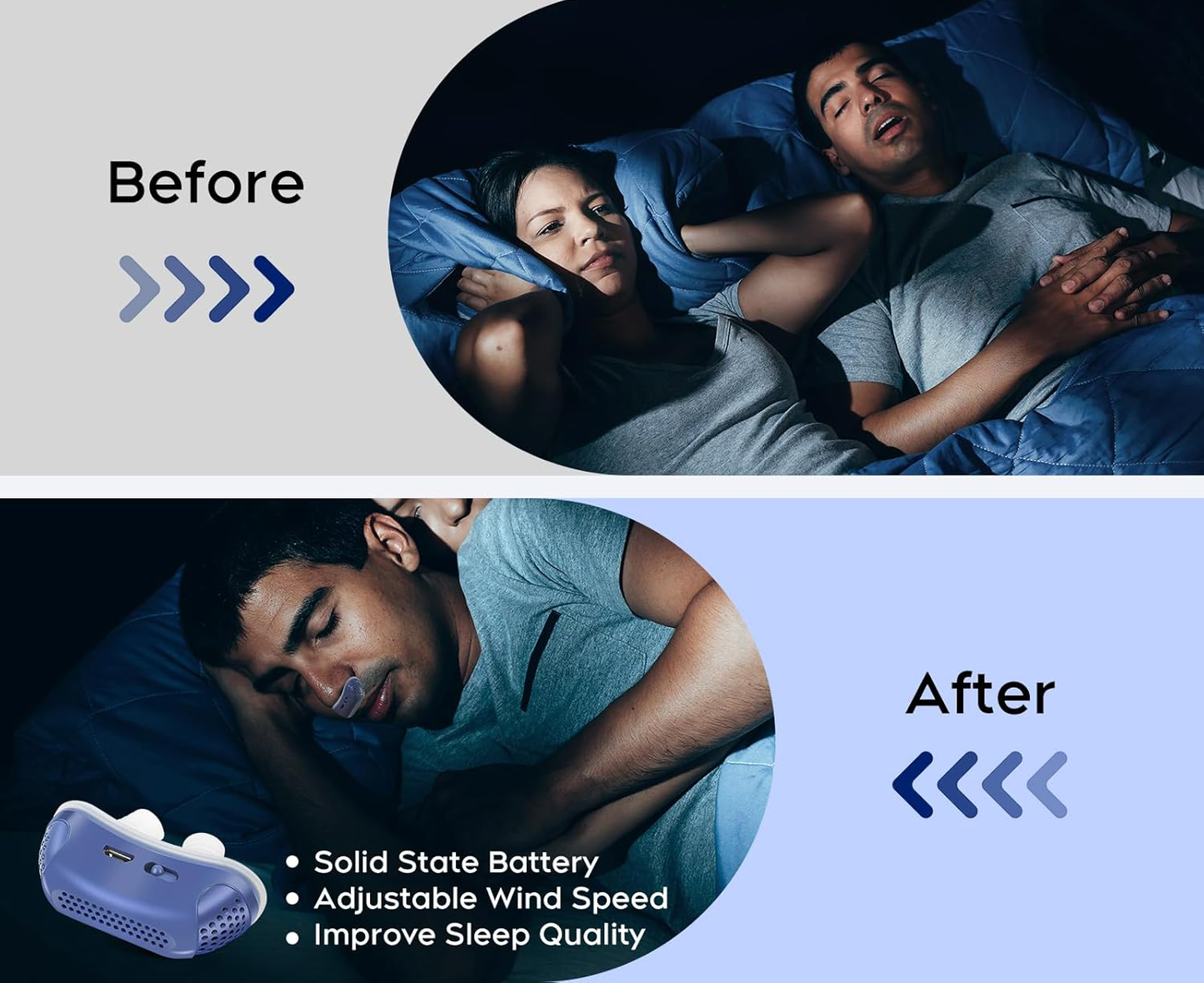 Portable Nose Vent for Quiet Sleep – Mini Snoring Relief Device