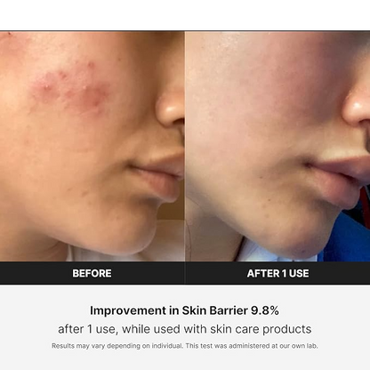 Revitalize Your Skin with the LuminaLift Facial Massager