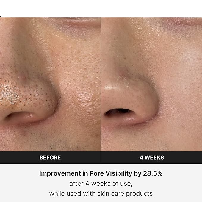 Revitalize Your Skin with the LuminaLift Facial Massager