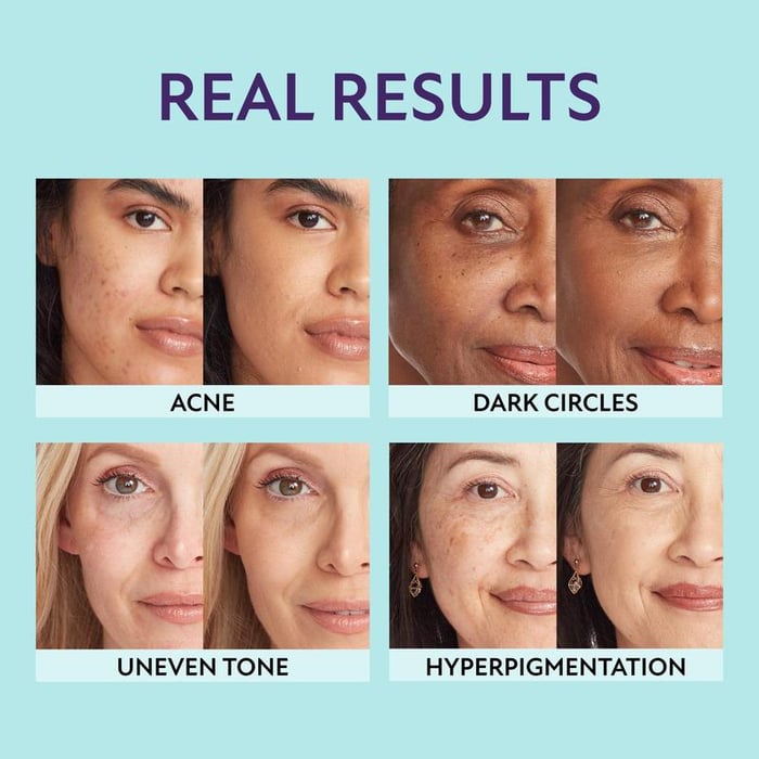 RadiantGlow – Hydrating Concealer for Natural Flawless Finish