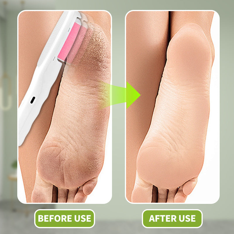 2-in-1 Electric Foot File and Hair Remover - 50% Off Special Offer
