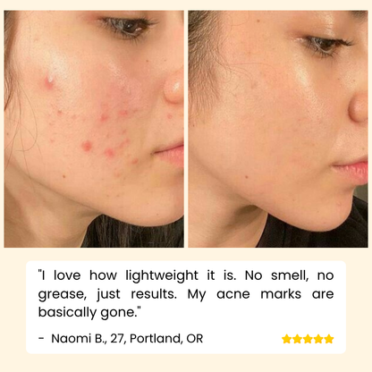 RadiantGlow Essence — Banish Dark Spots for Luminous Skin | Buy One Get One Free