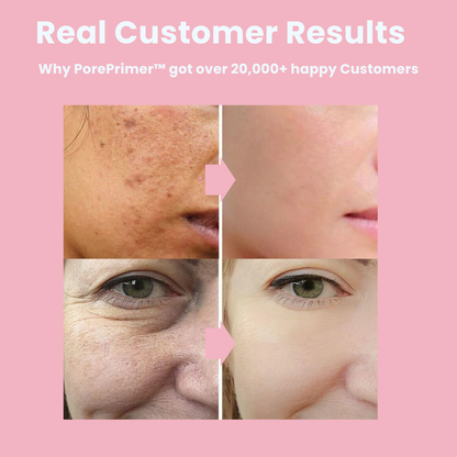 FlawlessSkin Elixir | Special Offer: Buy 1 Get 1 Free