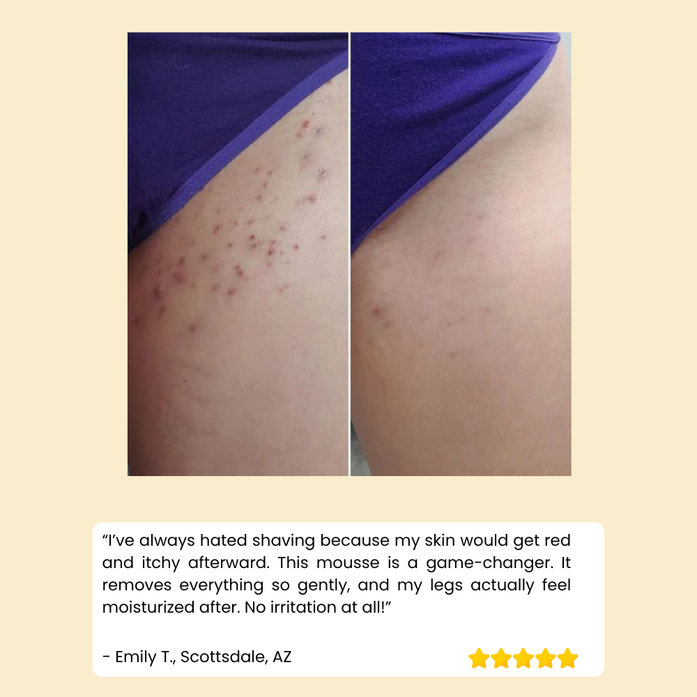 SilkenGlow™ - Experience Pain-Free, Irresistibly Smooth Skin for Weeks
