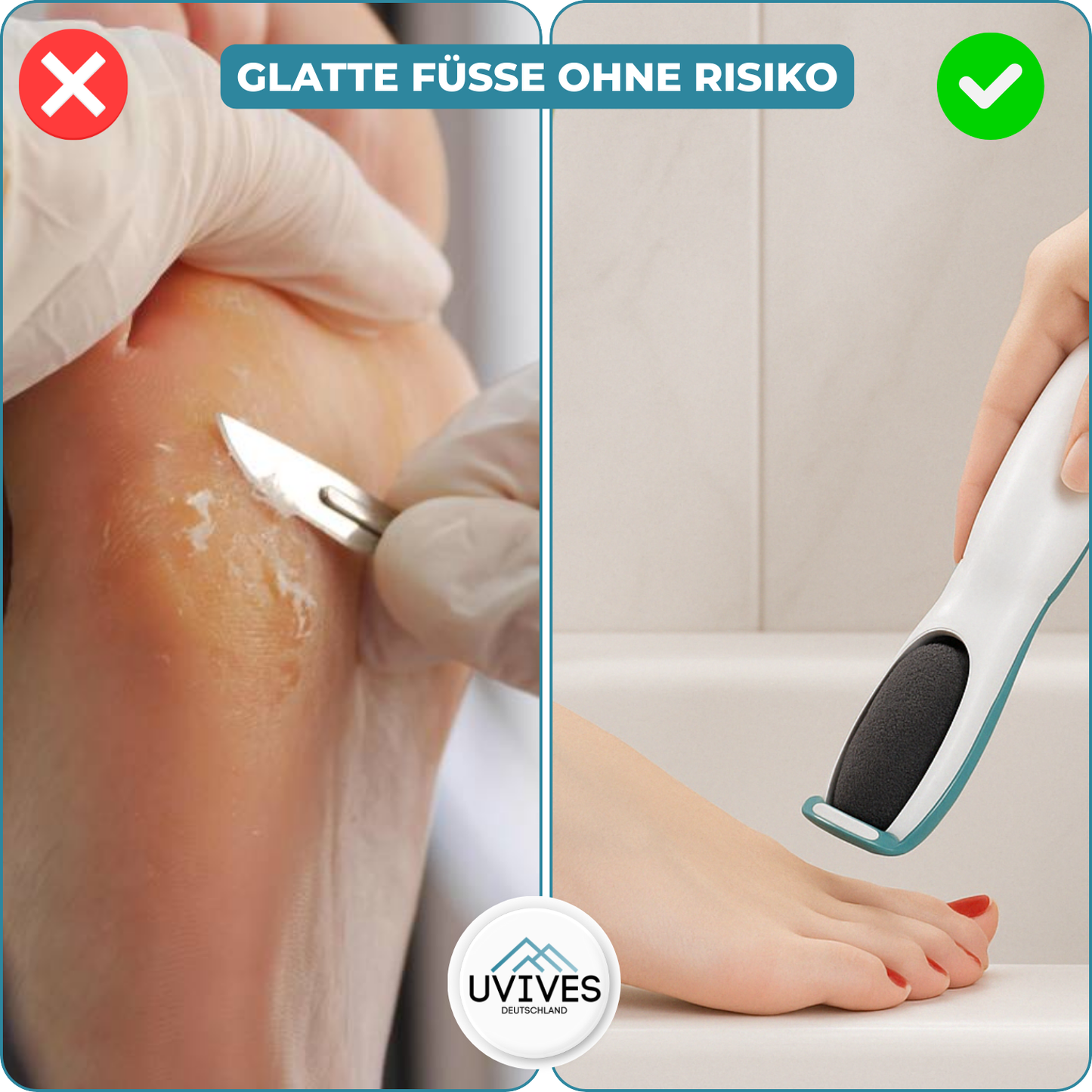 SilkaFeet – Effortlessly Smooth and Well-Groomed Feet