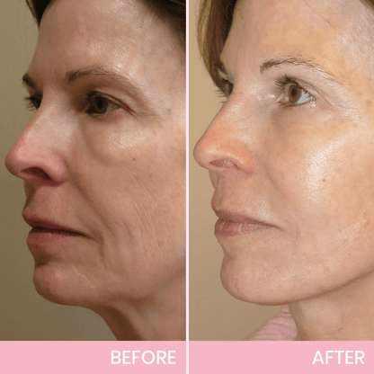 Invisible Lift Tape for Instant Contour Enhancement | Skin-Friendly & Comfortable | Perfect for Everyday Use & Special Events