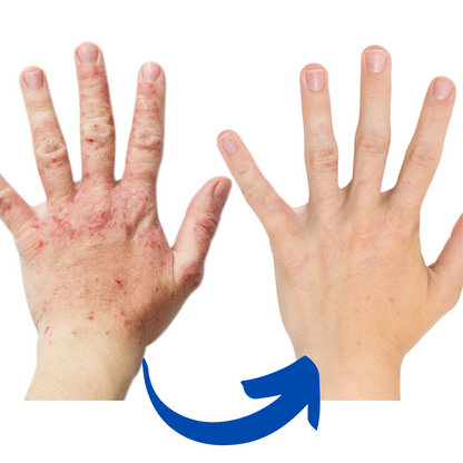 Soothing Hand Therapy Glove – Relief with Infrared Light