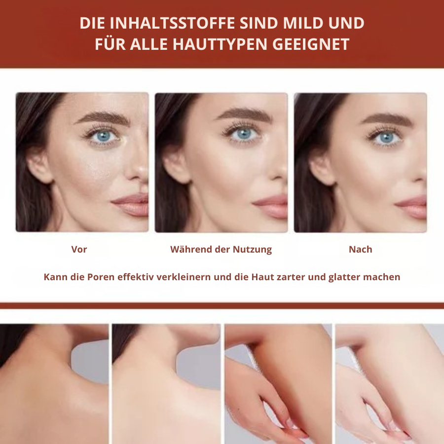 GlowPro Exfoliating Gel — Unleash Your Radiance with Gentle Brightening