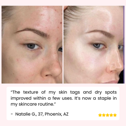 GlowEssence Exfoliating Gel – Reveal Radiant, Silky Skin Instantly