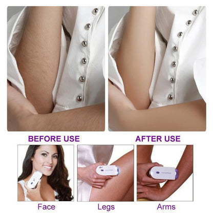 Portable Painless Hair Removal Device