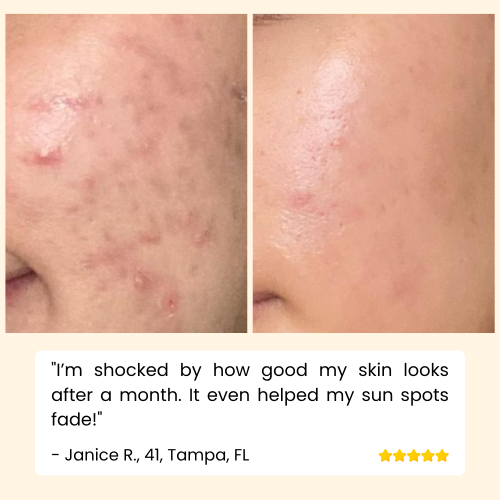 RadiantGlow Essence — Banish Dark Spots for Luminous Skin | Buy One Get One Free