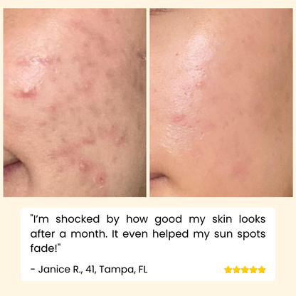 RadiantGlow Essence — Banish Dark Spots for Luminous Skin | Buy One Get One Free