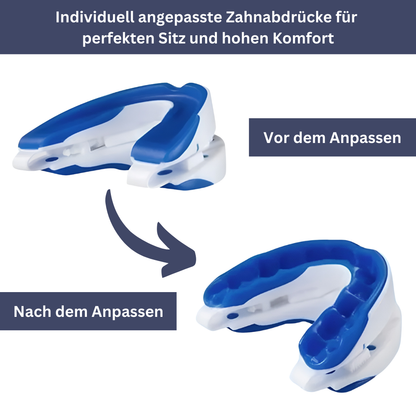 Silent Nights: Advanced Snoring Relief Device