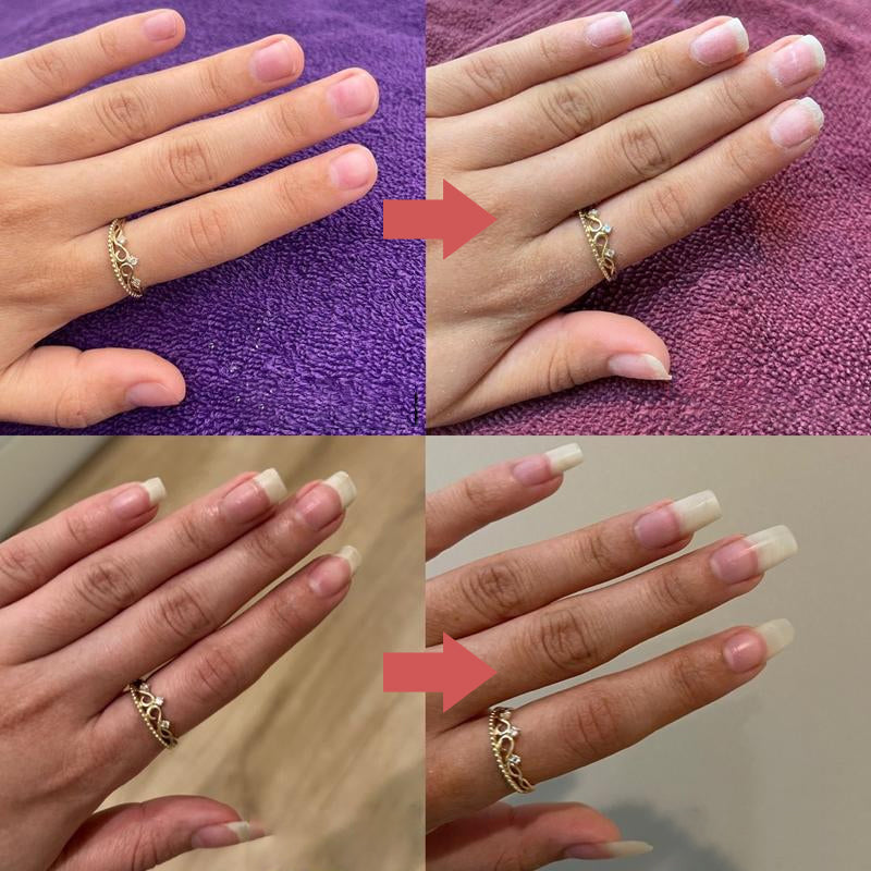 Nail Nourisher Pen for Stronger, Healthier Nails