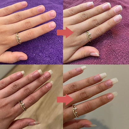 Nail Nourisher Pen for Stronger, Healthier Nails