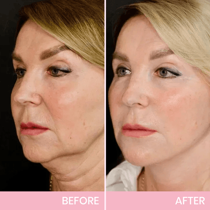 Invisible Lift Tape for Instant Contour Enhancement | Skin-Friendly & Comfortable | Perfect for Everyday Use & Special Events