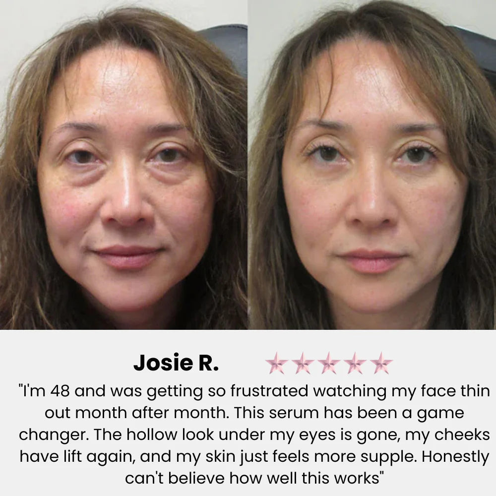 Youthful Radiance Serum — Instantly Firm and Glow with Confidence