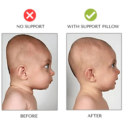 Free Set: Support Pillow for Flat Head Prevention