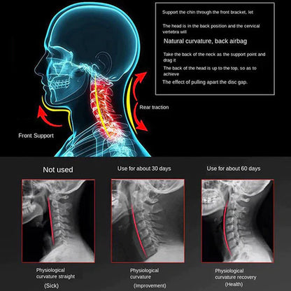 Neck Support Brace for Pain Relief