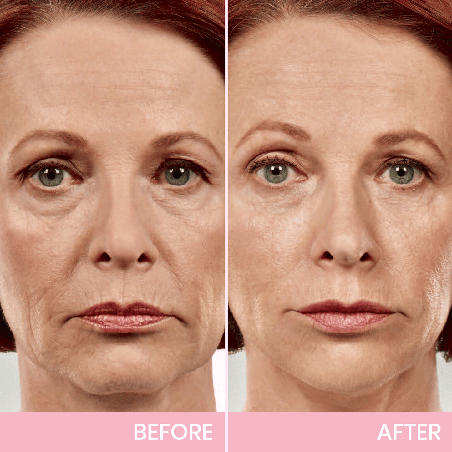 Invisible Lift Tape for Instant Contour Enhancement | Skin-Friendly & Comfortable | Perfect for Everyday Use & Special Events