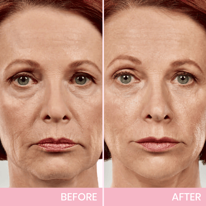 Invisible Lift Tape for Instant Contour Enhancement | Skin-Friendly & Comfortable | Perfect for Everyday Use & Special Events