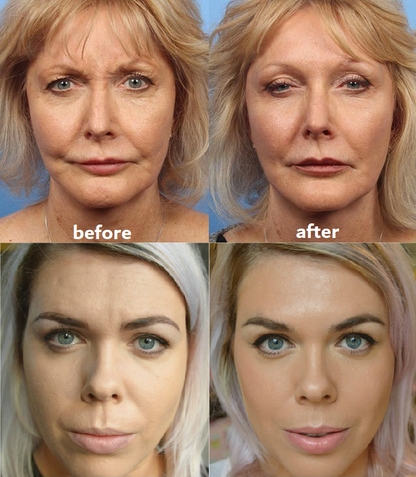 Rejuvenating Anti-Aging Skin Pads for Visible Results