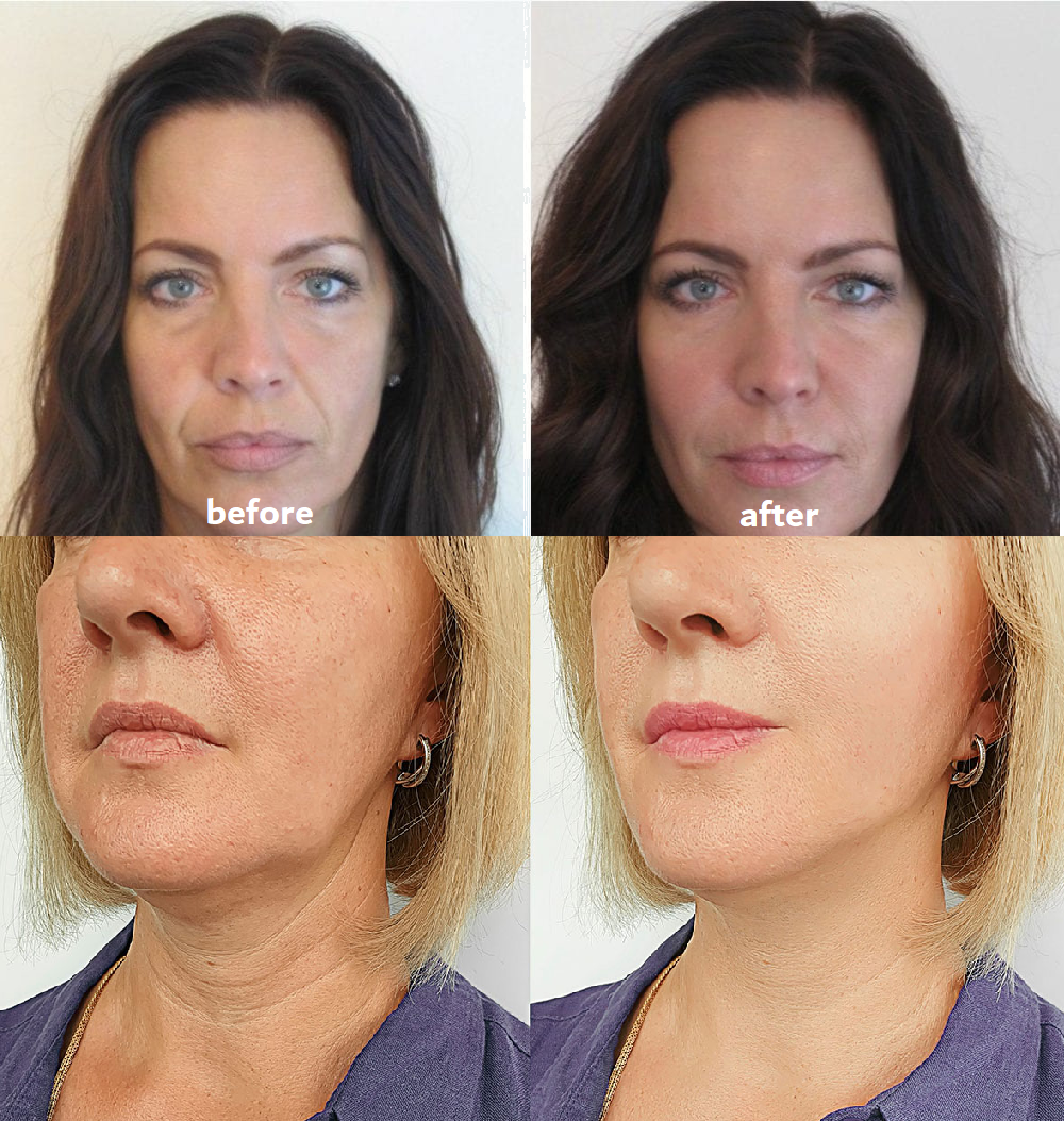 Rejuvenating Anti-Aging Skin Pads for Visible Results