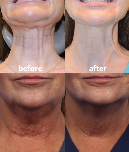 Rejuvenating Anti-Aging Skin Pads for Visible Results