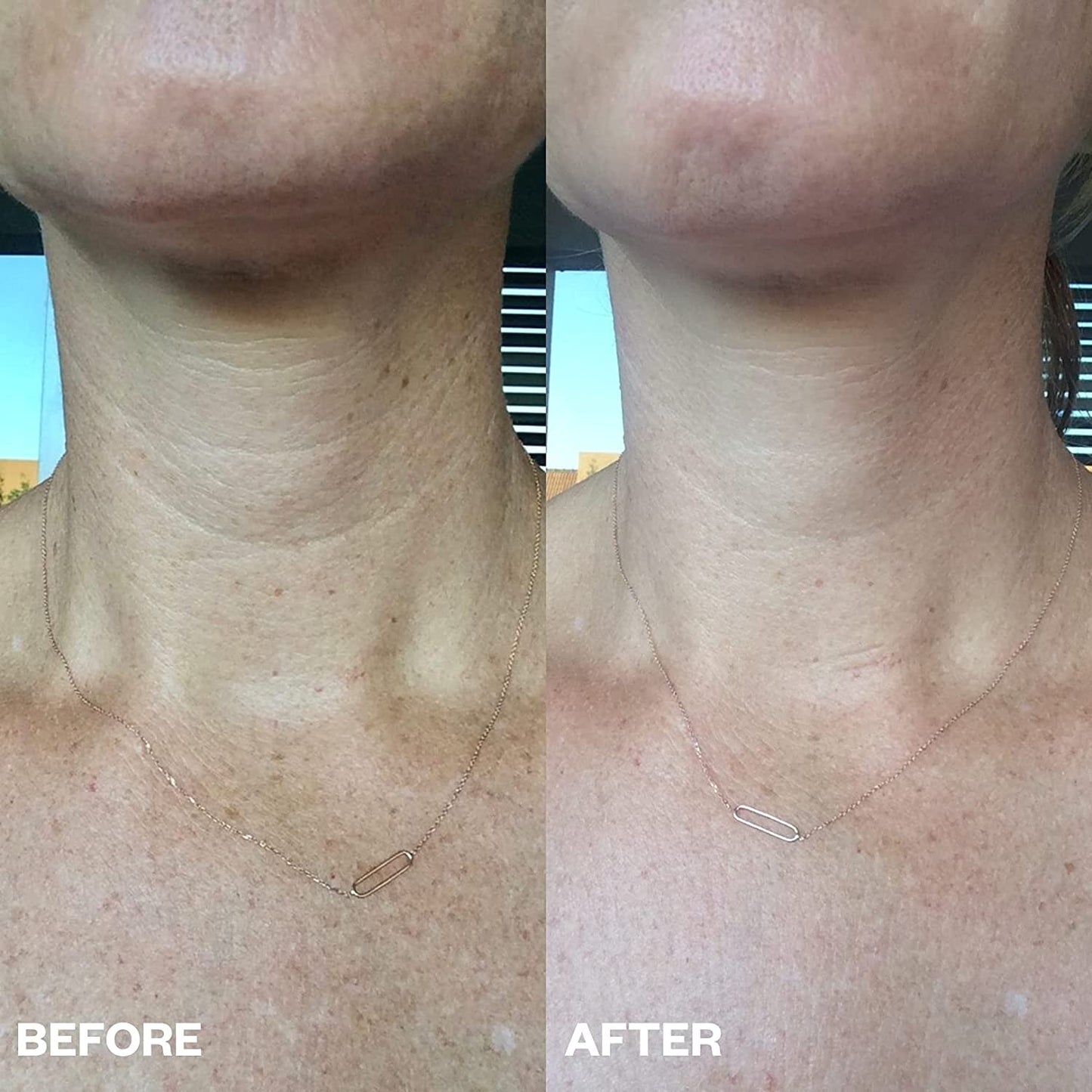 Rejuvenating Anti-Aging Skin Pads for Visible Results
