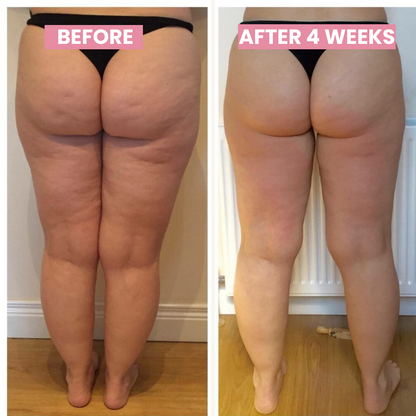 SmoothSkin Pro: Advanced Cupping and Scraping System