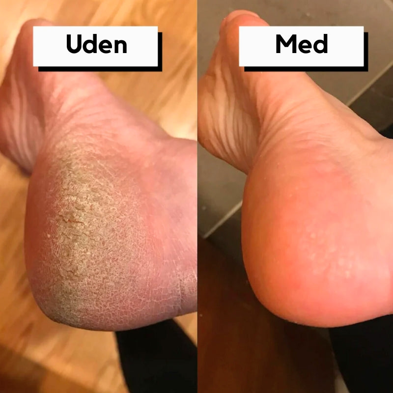 Revitalizing Electric Foot Spa & Callus Eliminator