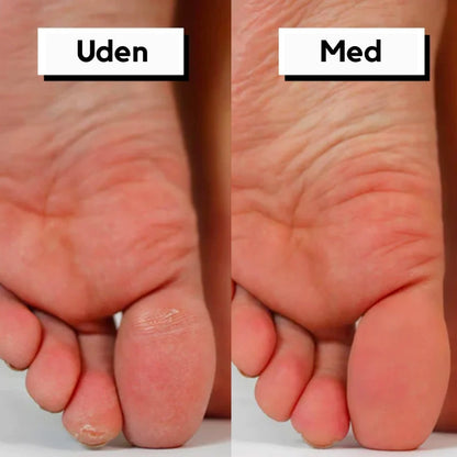 Revitalizing Electric Foot Spa & Callus Eliminator
