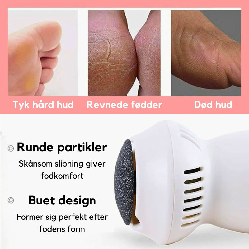 Revitalizing Electric Foot Spa & Callus Eliminator