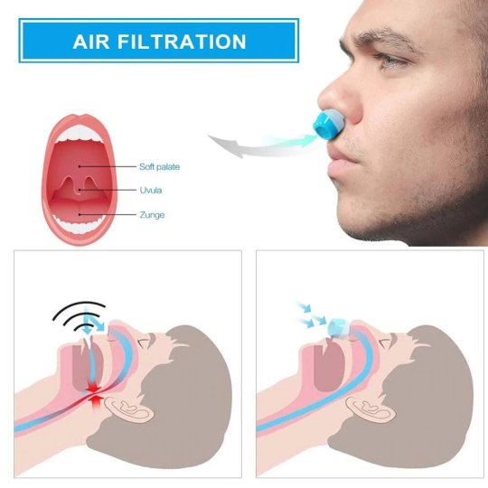 Portable Sleep Aid for Snoring Relief and Sleep Apnea