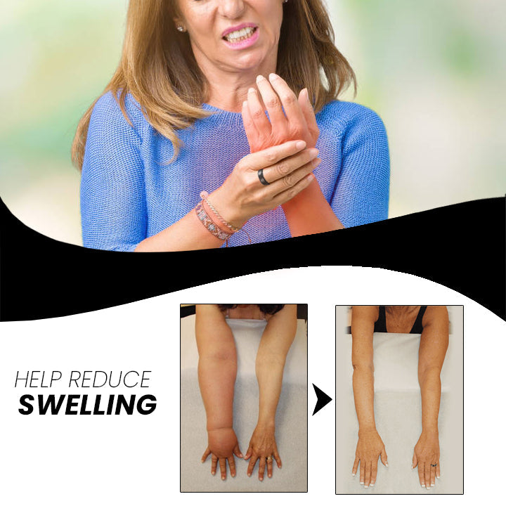Revitalize Hand Therapy Ring | Adjustable Comfort & Wellness