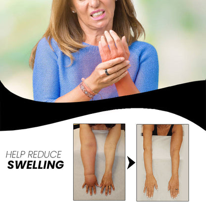 Revitalize Hand Therapy Ring | Adjustable Comfort & Wellness