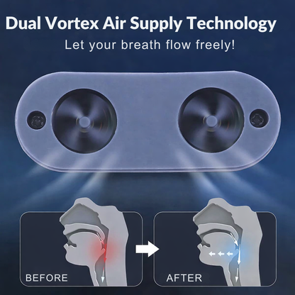SnoreEase: Compact USB Rechargeable Breathing Aid