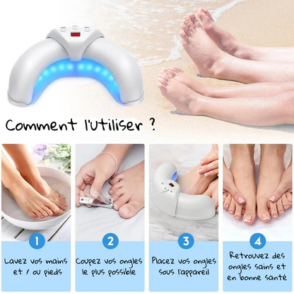 Home Nail Restoration Laser System