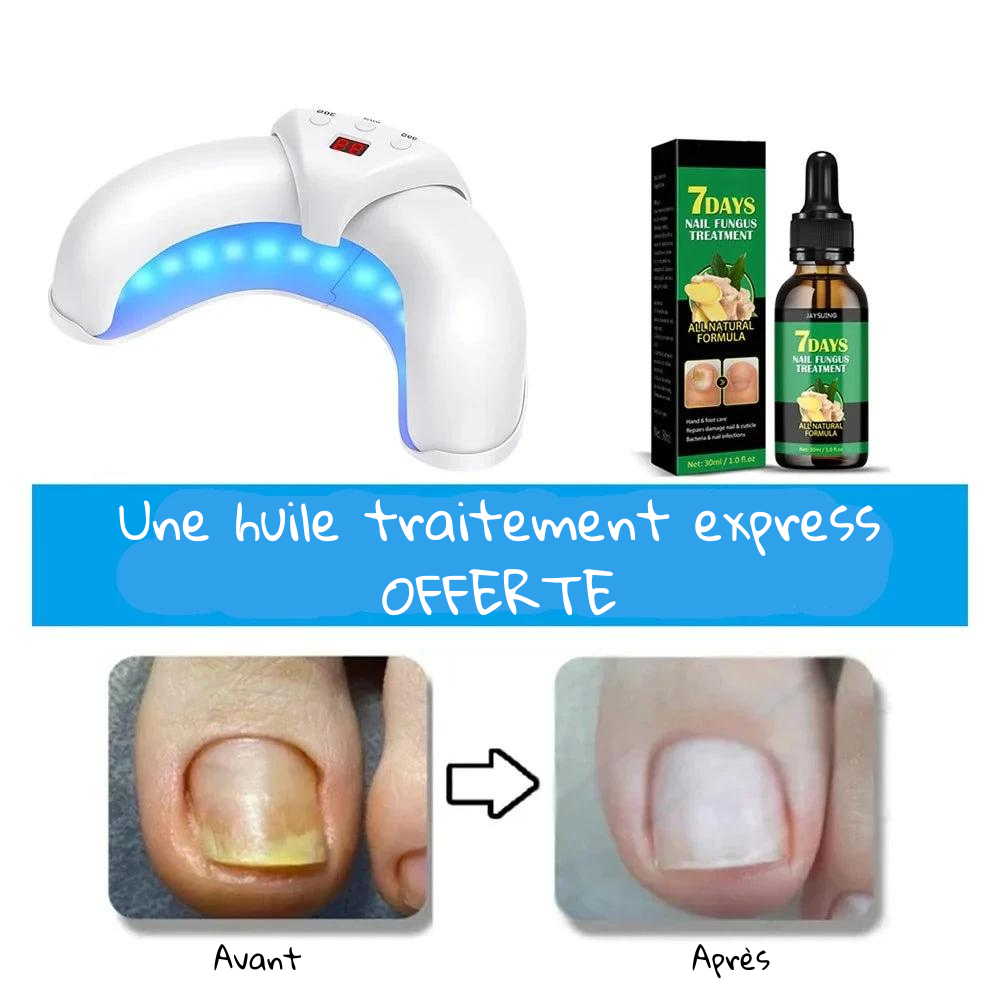 Home Nail Restoration Laser System