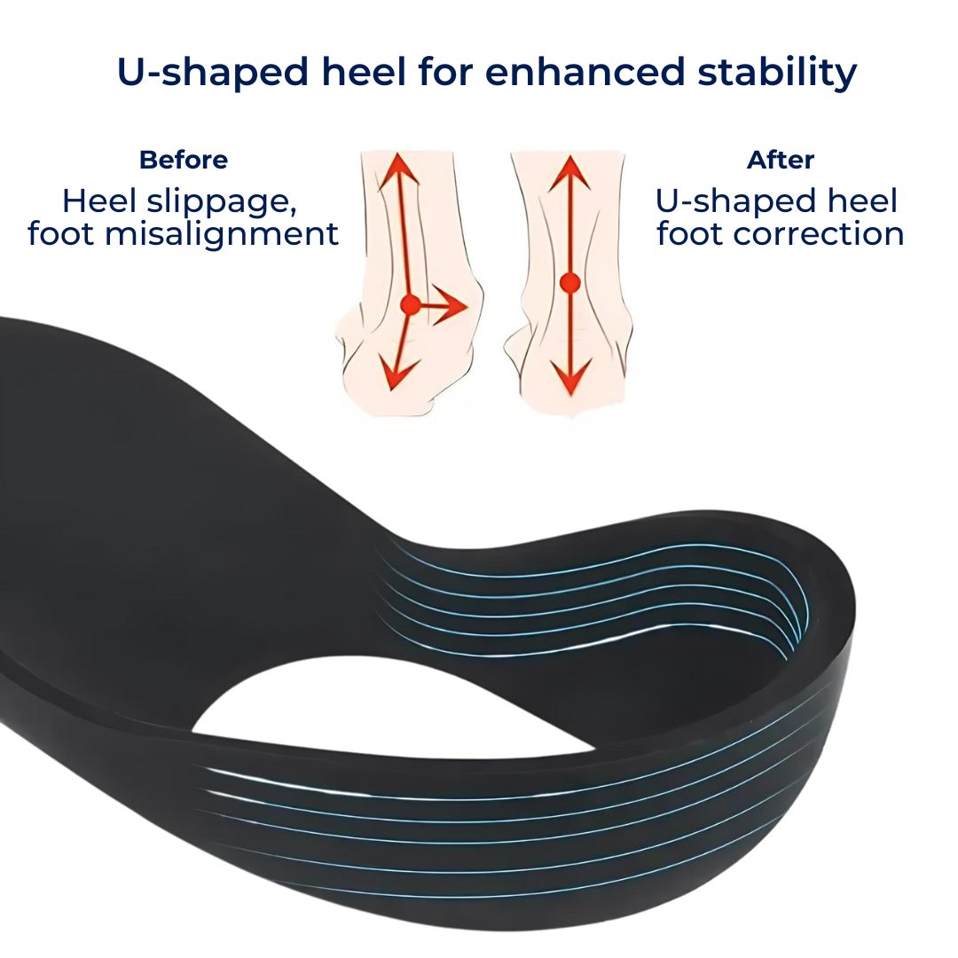 Shoe Insoles for Flat Feet - Arch Support Inserts for Plantar Fasciitis