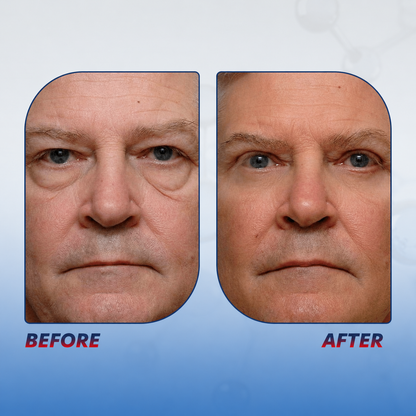 Augen-Erneuerung | Peptid Lifting Gel | Kojicsäure & Koffein | LumiEye
