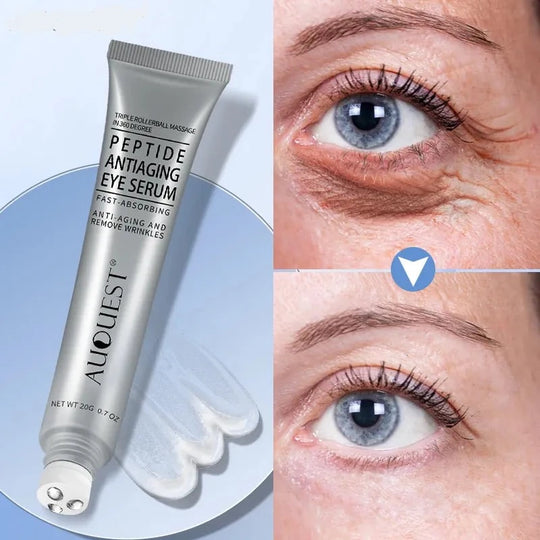 RevitalEyes Cream | Hydrating Treatment for Youthful Skin